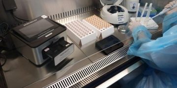 FIERBERE CU BURBULUCI PE ADJUDECAREA LISTEI DE INVESTIȚII, APARATURĂ MEDICALĂ ȘI APARAT PCR , DIN DSP OLT ! VALOAREA/500 MII LEI ! PRIMA LISTĂ APROBATĂ DE MINISTERUL SĂNĂTĂȚII,  MODIFICATĂ !